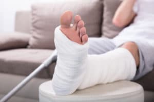 A person resting their injured foot in a cast. 